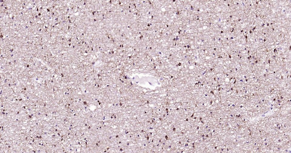 离子型谷氨酸受体1重组兔单抗