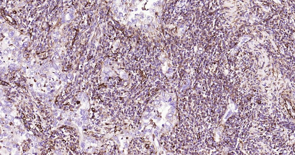 波形蛋白抗体-bs-23063R