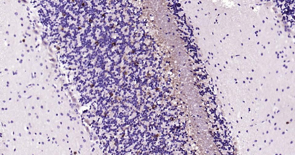 离子型谷氨酸受体1重组兔单抗