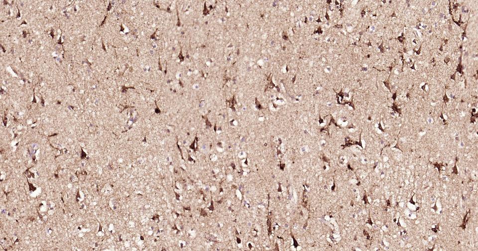 骨桥蛋白/分泌型磷蛋白1重组兔单抗