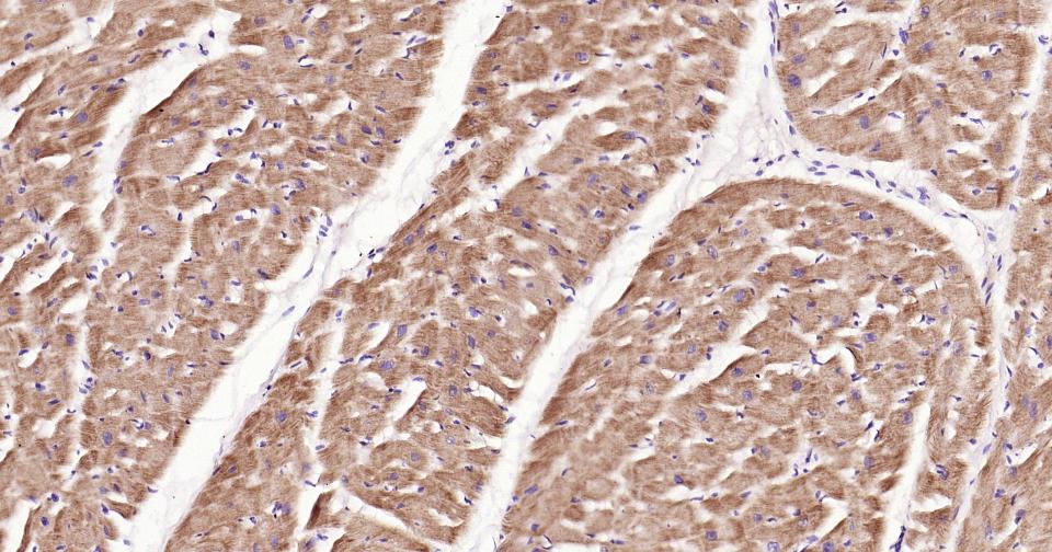 磷脂酰肌醇激酶3催化亚单位3重组兔单抗