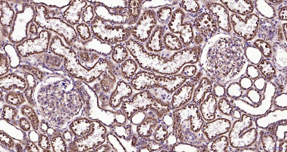 溶酶体相关膜蛋白1(CD107)重组兔单抗