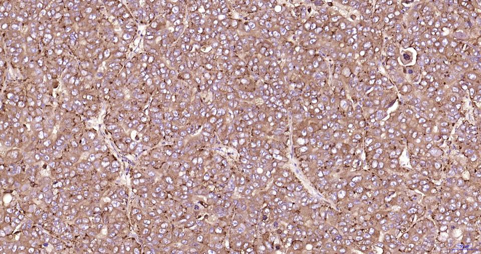 溶酶体相关膜蛋白1(CD107)重组兔单抗