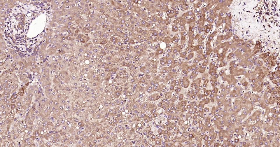 凋亡蛋白活性因子-1重组兔单抗