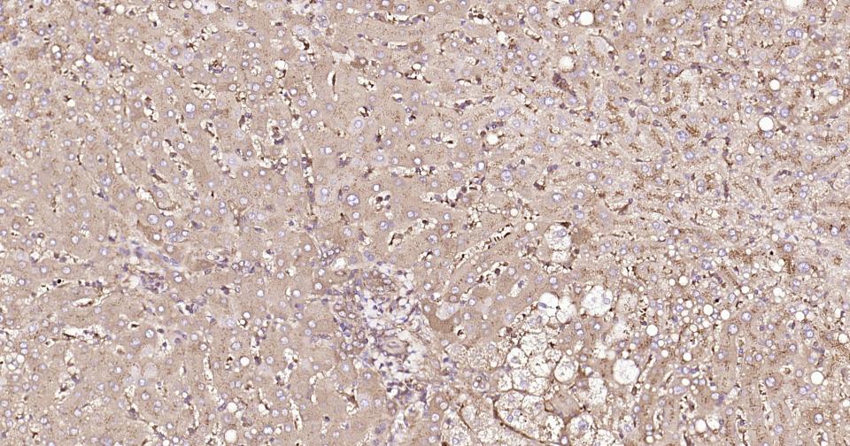 α-1抗胰糜蛋白酶/SERPINA3重组兔单克隆抗体