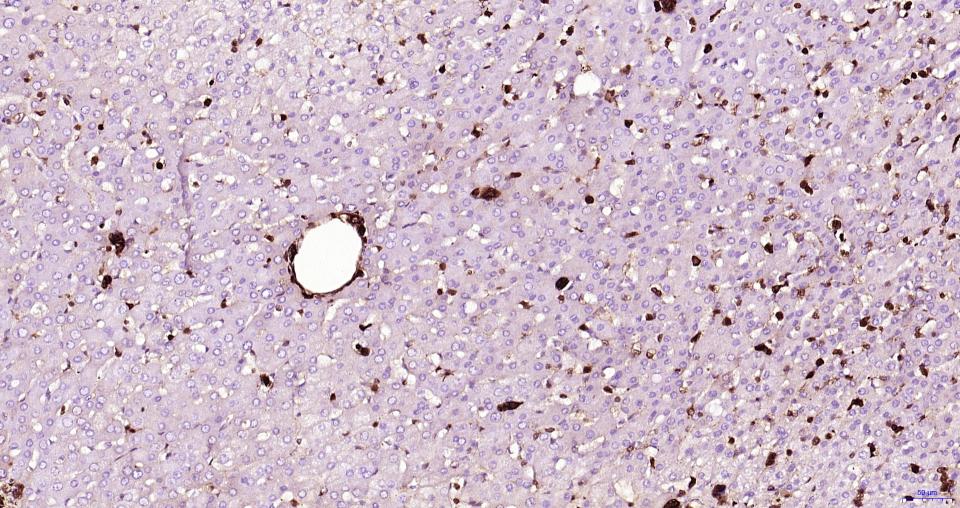 S100钙结合蛋白A6重组兔单抗