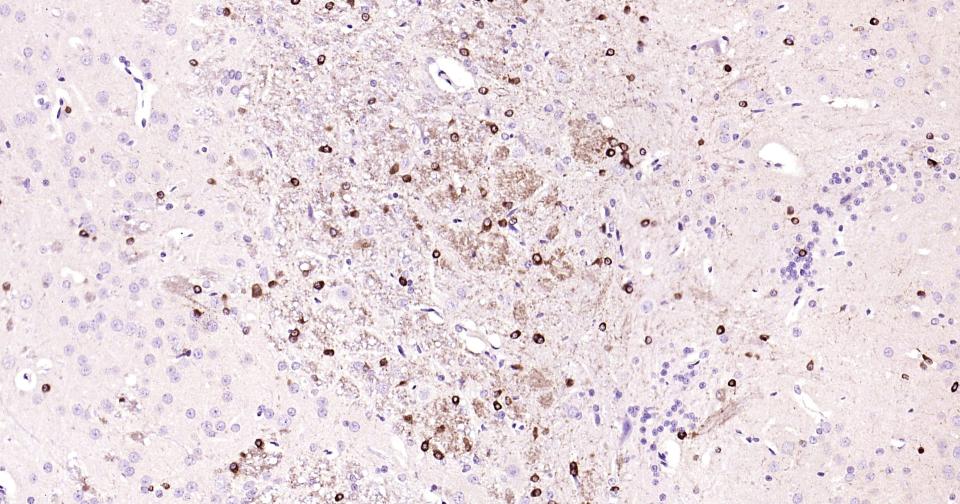 离子型谷氨酸受体1重组兔单抗