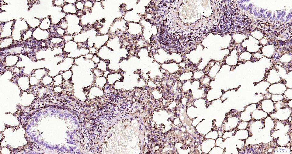 S100钙结合蛋白A6重组兔单抗