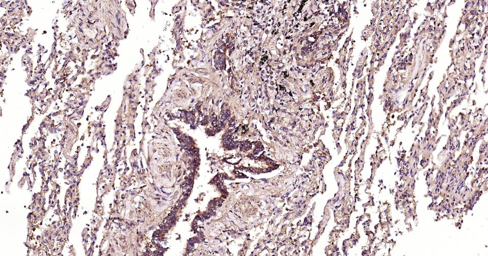 干细胞生长因子重组兔单抗