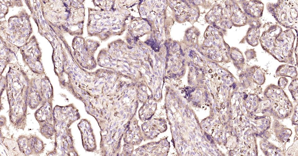 α-1抗胰糜蛋白酶/SERPINA3重组兔单克隆抗体