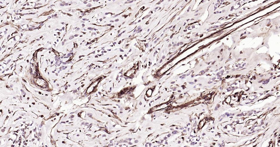 波形蛋白抗体-bs-0756R