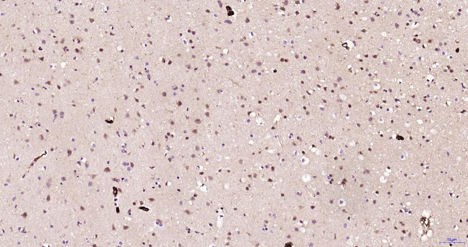 S100钙结合蛋白A6重组兔单抗
