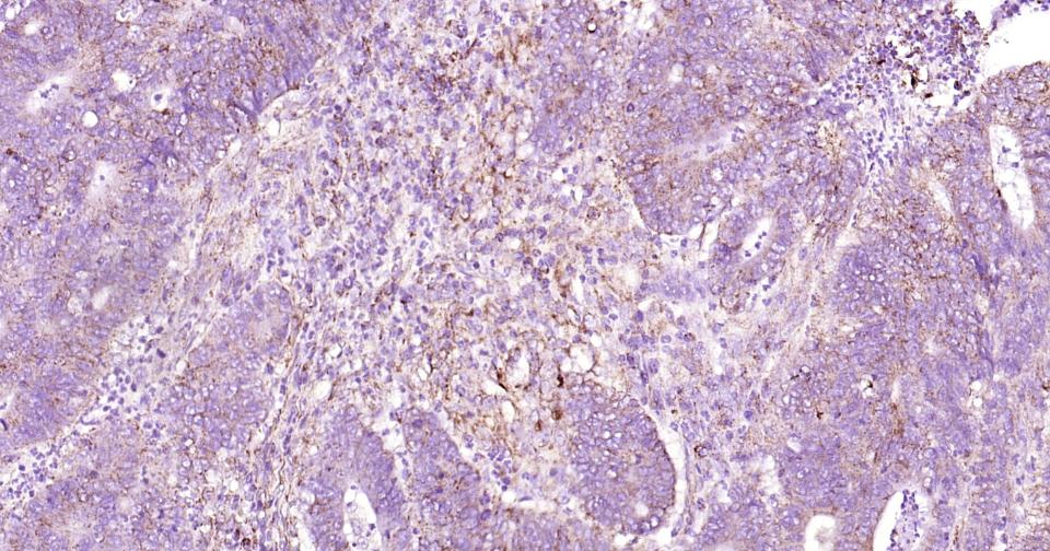 骨桥蛋白/分泌型磷蛋白1重组兔单抗