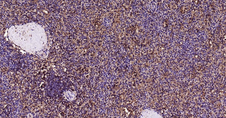 凋亡蛋白活性因子-1重组兔单抗