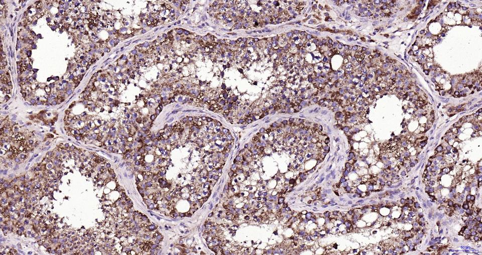溶酶体相关膜蛋白1(CD107)重组兔单抗