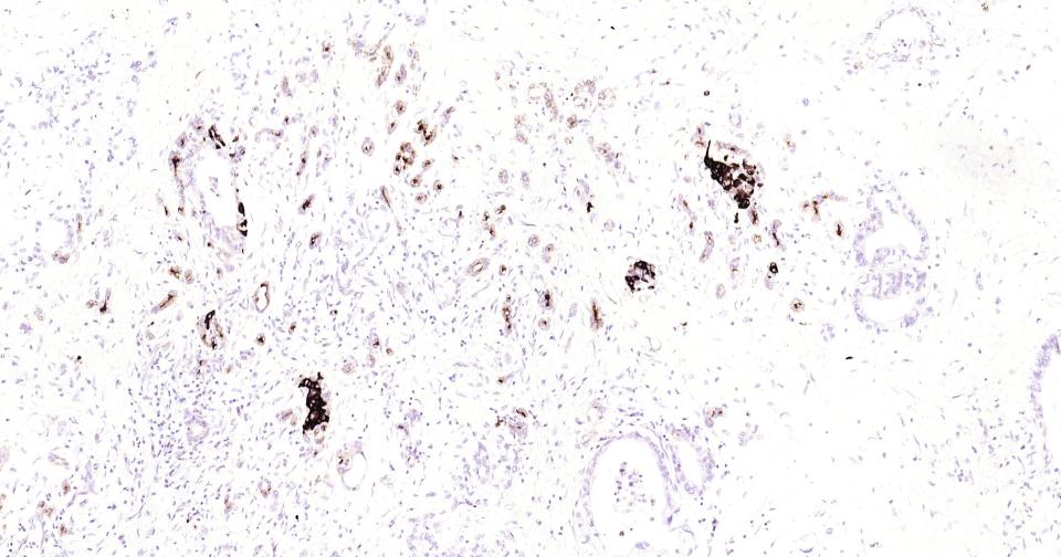 骨桥蛋白/分泌型磷蛋白1重组兔单抗