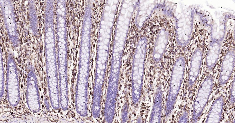 波形蛋白抗体-bs-8533R