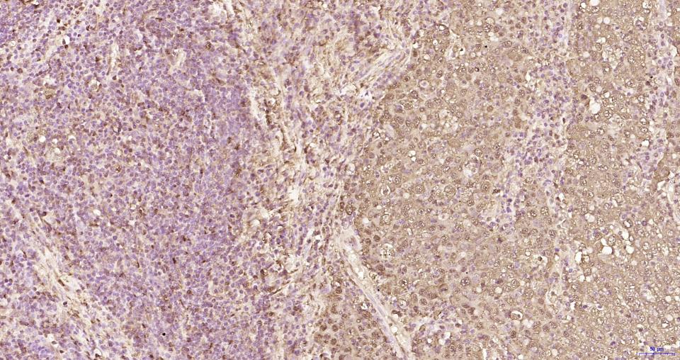 S100钙结合蛋白A6重组兔单抗