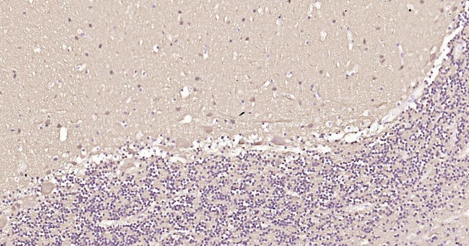 自噬微管相关蛋白轻链3重组兔单抗