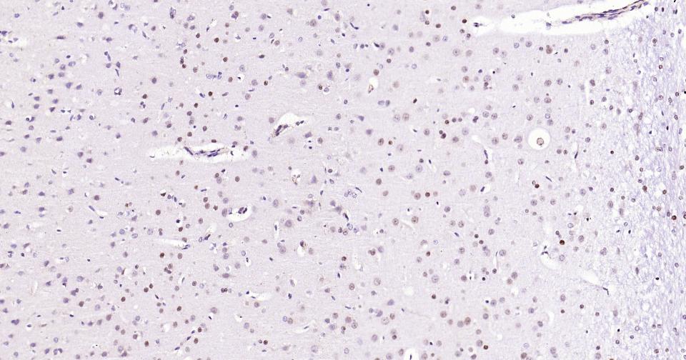 DNA甲基转移酶-3α重组兔单抗