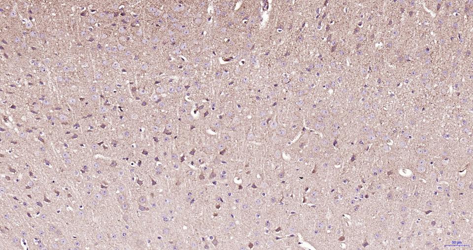 帕金蛋白重组兔单抗