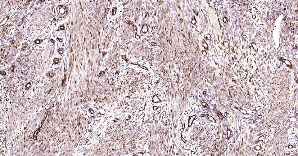 波形蛋白抗体-bs-8533R