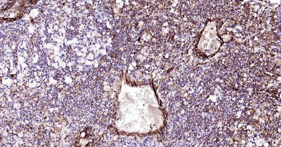 波形蛋白抗体-bs-0756R