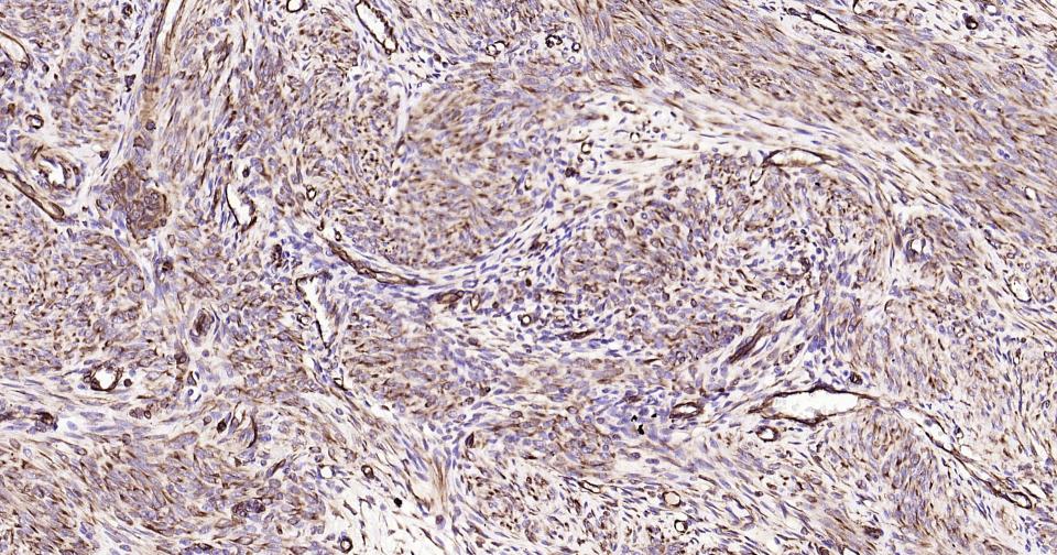 波形蛋白抗体-bs-23063R