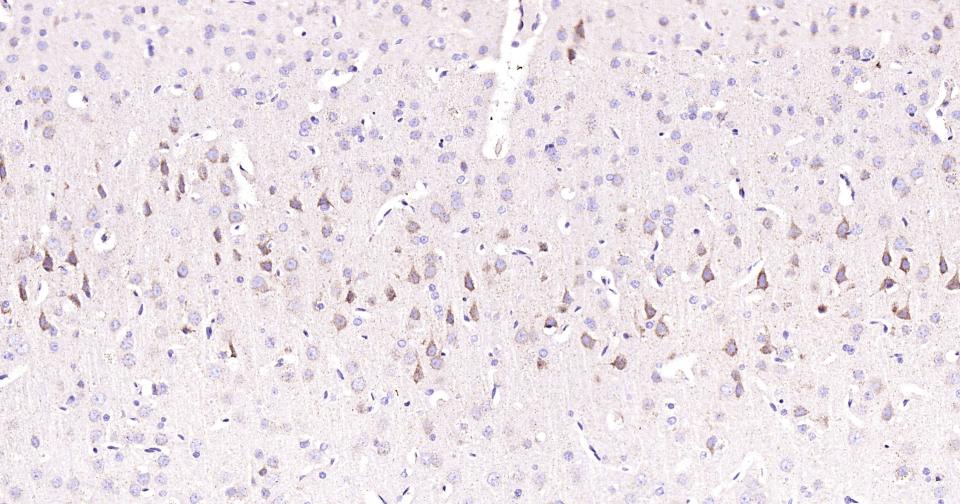 磷脂酰肌醇激酶3催化亚单位3重组兔单抗