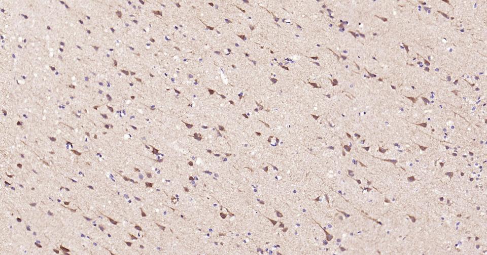 磷脂酰肌醇激酶3催化亚单位3重组兔单抗