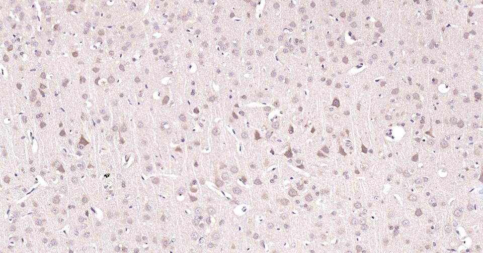 色氨酸羟化酶1重组兔单抗