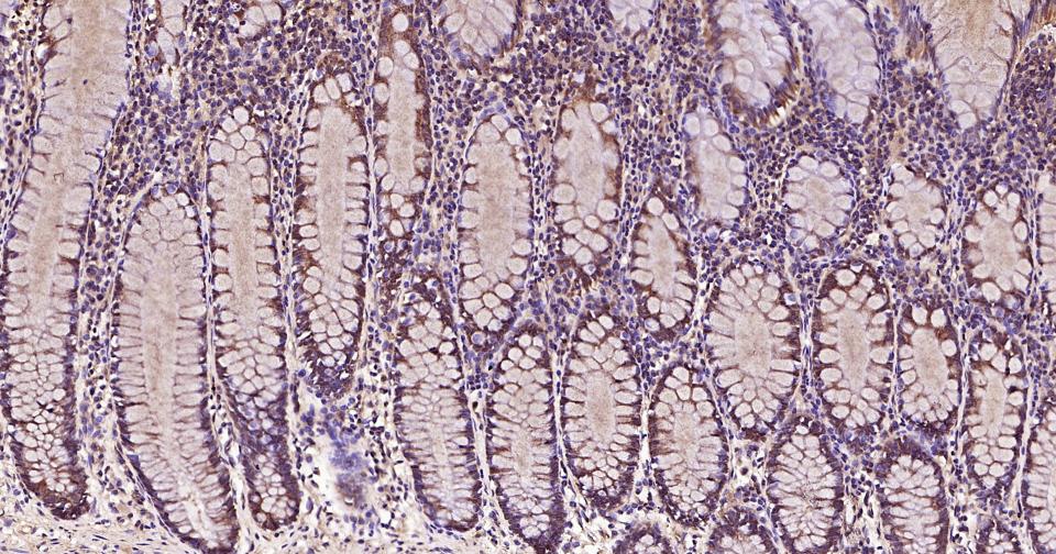 干细胞生长因子重组兔单抗