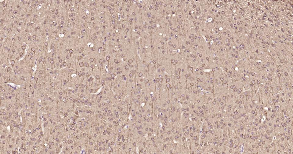 自噬微管相关蛋白轻链3重组兔单抗