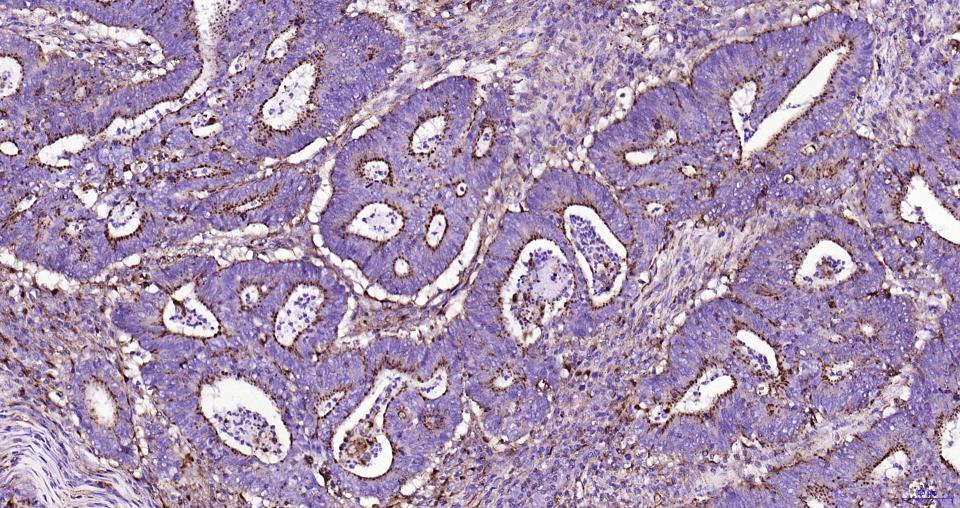 溶酶体相关膜蛋白1(CD107)重组兔单抗