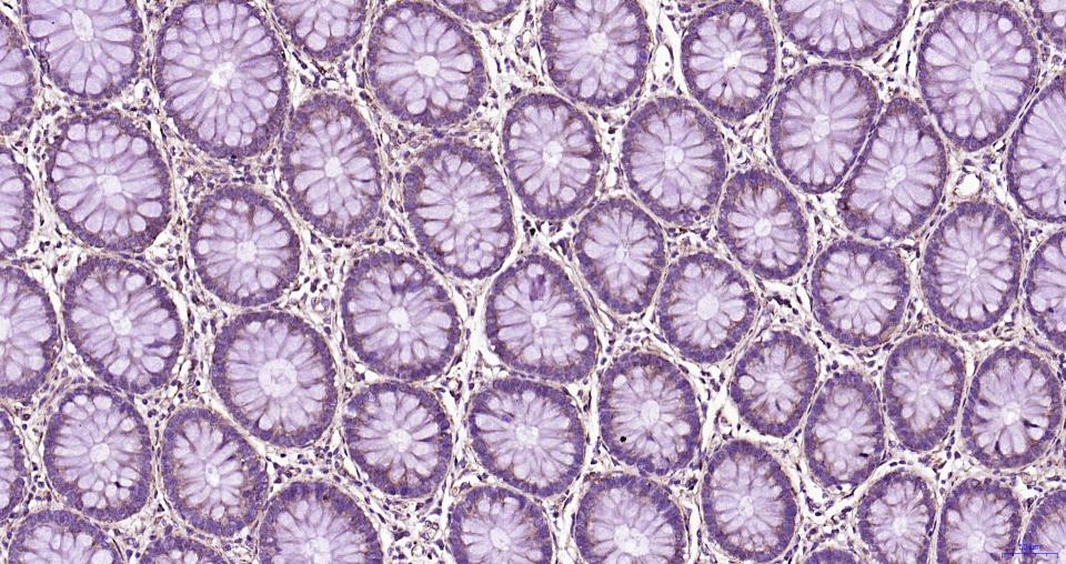 帕金蛋白重组兔单抗