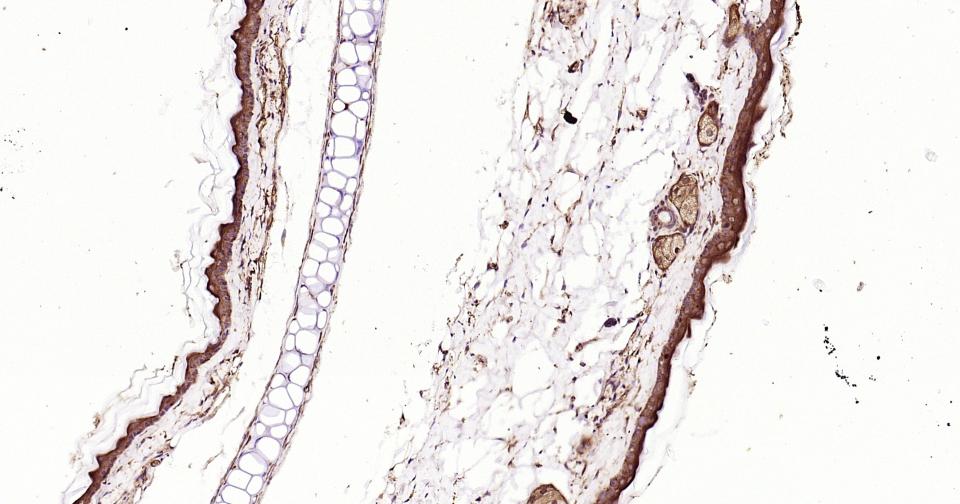 凋亡蛋白活性因子-1重组兔单抗