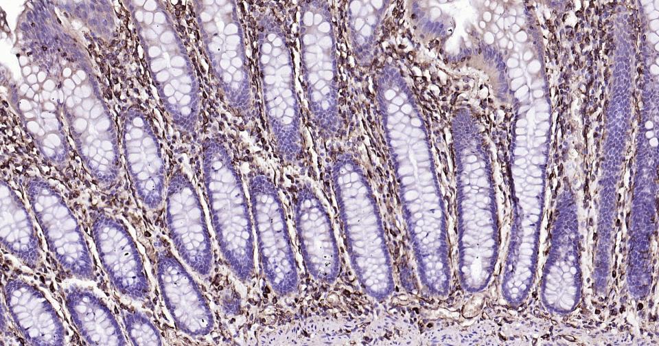 波形蛋白抗体-bs-0756R