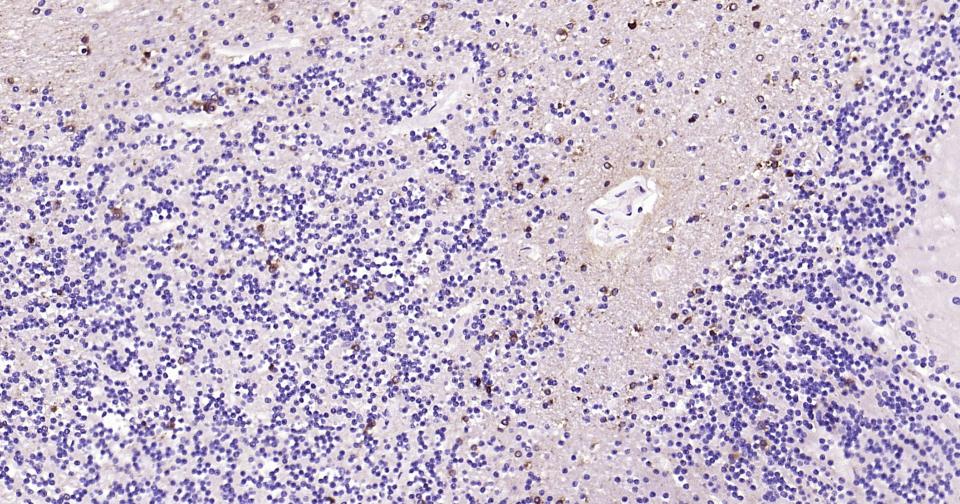 离子型谷氨酸受体1重组兔单抗