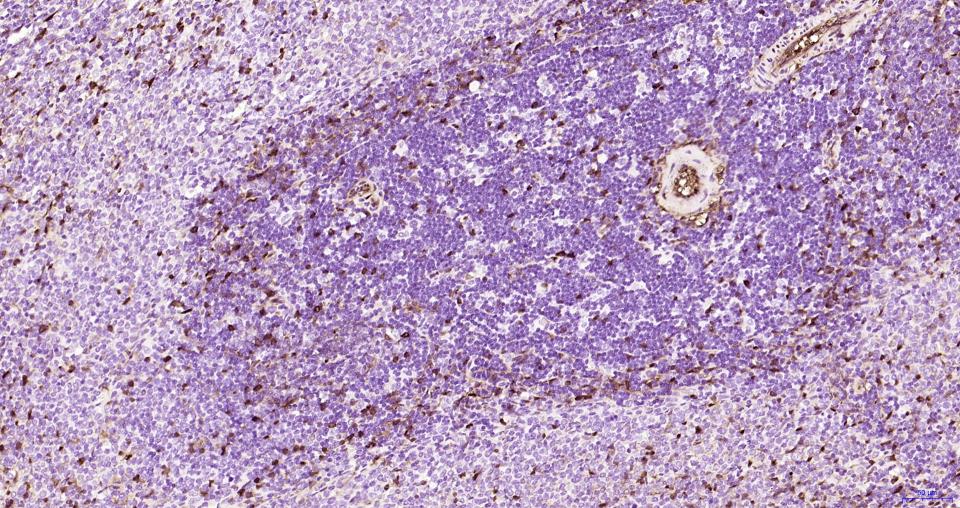 S100钙结合蛋白A6重组兔单抗