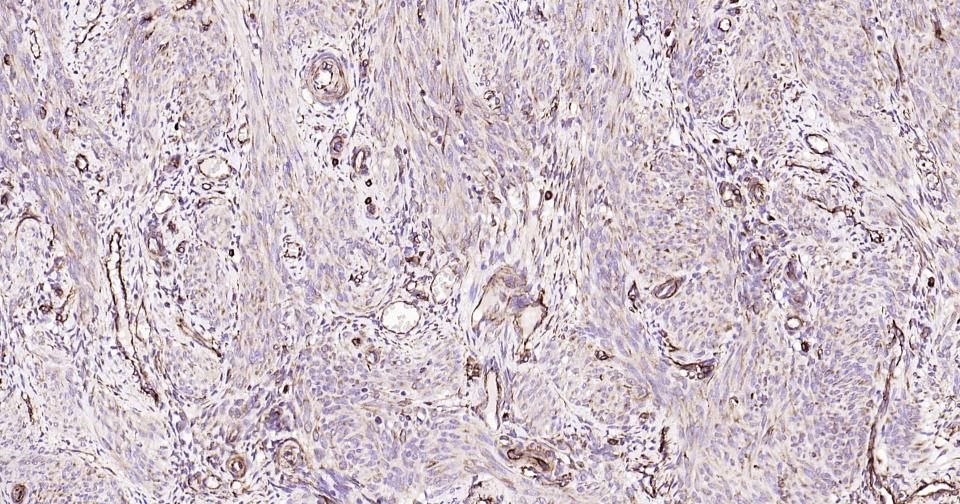 波形蛋白抗体-bs-0756R