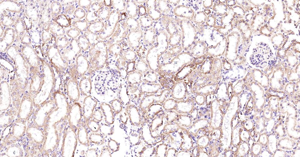 磷脂酰肌醇激酶3催化亚单位3重组兔单抗