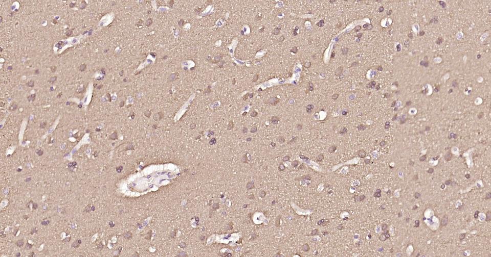 自噬微管相关蛋白轻链3重组兔单抗