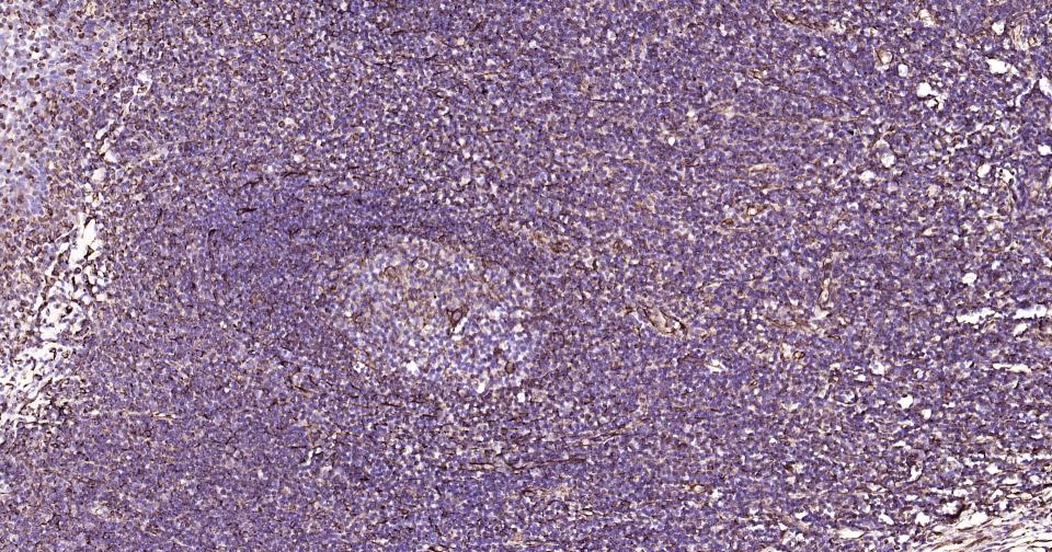 波形蛋白抗体-bs-8533R