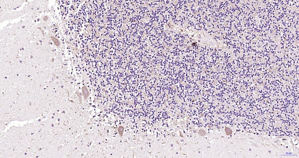 帕金蛋白重组兔单抗