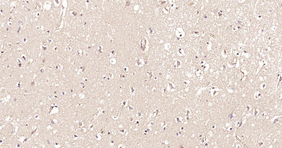 干细胞生长因子重组兔单抗