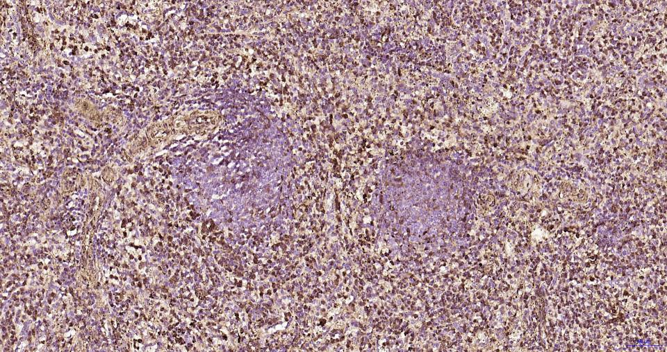 S100钙结合蛋白A6重组兔单抗