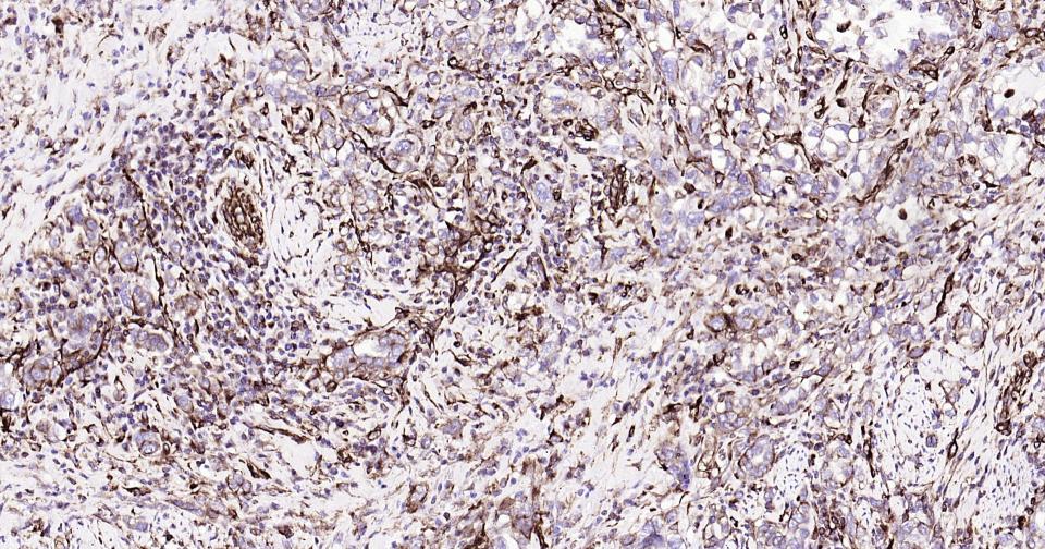 波形蛋白抗体-bs-8533R