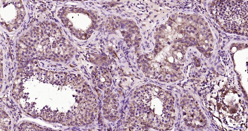 帕金蛋白重组兔单抗