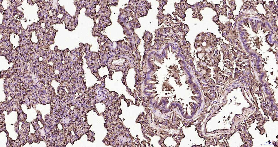 S100钙结合蛋白A6重组兔单抗