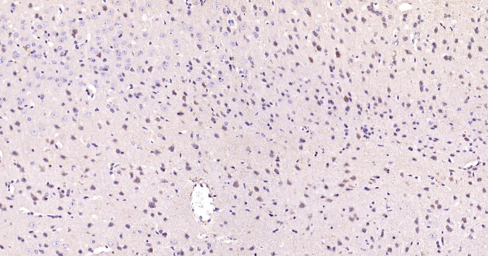磷脂酰肌醇激酶3催化亚单位3重组兔单抗